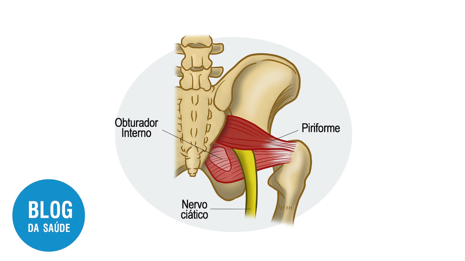 Síndrome do Piriforme Ceimec